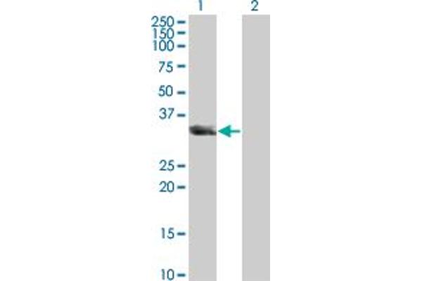 anti-Unc-119 Homolog (UNC119) (AA 1-240) antibody