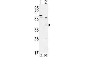 Image no. 1 for anti-TGFB-Induced Factor Homeobox 1 (TGIF1) (AA 152-182), (Middle Region) antibody (ABIN955178)