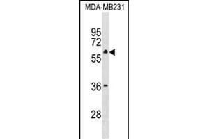 TBC1D10A Antibody (Center) (ABIN1538162 and ABIN2838129) western blot analysis in MDA-M cell line lysates (35 μg/lane).