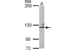 Image no. 2 for anti-NCK Associated Protein 1 (NCKAP1) (Internal Region) antibody (ABIN2856158)