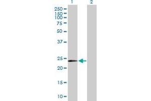Image no. 1 for anti-Protein L-Myc (MYCL) (AA 1-206) antibody (ABIN518131)