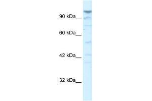Image no. 2 for anti-La Ribonucleoprotein Domain Family, Member 1B (LARP1B) (Middle Region) antibody (ABIN2775855)