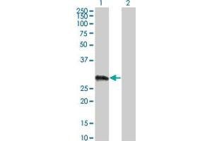 anti-Variable Charge, X-Linked 3A (VCX3A) (AA 2-100) antibody
