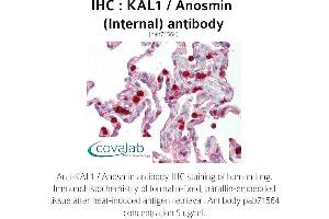 Image no. 2 for anti-Kallmann Syndrome 1 Sequence (KAL1) (Internal Region) antibody (ABIN1736141)