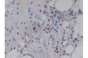 Image no. 3 for anti-Colony Stimulating Factor 2 Receptor, Alpha, Low-Affinity (Granulocyte-Macrophage) (CSF2RA) (AA 28-112) antibody (ABIN1867408)