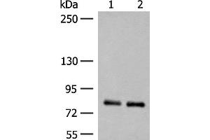 Western blot analysis of Rat brain tissue and Mouse brain tissue lysates using NGEF Polyclonal Antibody at dilution of 1:250