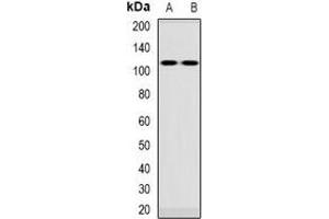 Image no. 2 for anti-Vacuolar Protein Sorting 54 Homolog (VPS54) antibody (ABIN3223020)