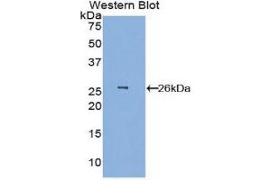 Image no. 1 for anti-Elastin Microfibril Interfacer 1 (EMILIN1) (AA 803-1016) antibody (ABIN1858712)