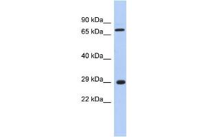 Image no. 1 for anti-AKT Interacting Protein (AKTIP) (Middle Region) antibody (ABIN1449900)