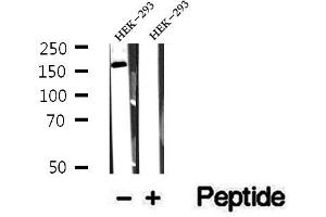 Image no. 2 for anti-Centrosomal Protein 164kDa (CEP164) antibody (ABIN6260765)