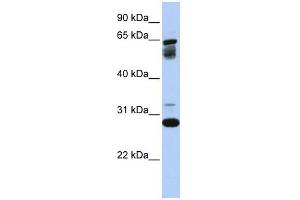 Image no. 1 for anti-Transmembrane Protein 187 (TMEM187) (Middle Region) antibody (ABIN635956)