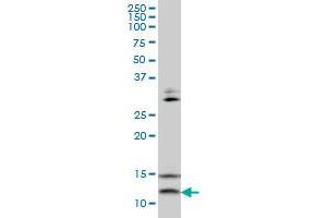 Image no. 3 for anti-Vesicle-Associated Membrane Protein 1 (Synaptobrevin 1) (VAMP1) (AA 28-96) antibody (ABIN563072)
