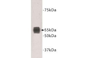 Image no. 1 for anti-Transmembrane Protein 132A (TMEM132A) antibody (ABIN1854988)