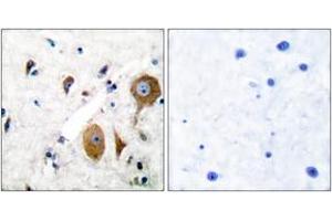 Image no. 2 for anti-Glutamate Receptor, Metabotropic 8 (GRM8) (AA 841-890) antibody (ABIN1533293)
