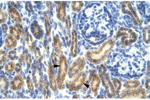 Image no. 3 for anti-Hematopoietic Cell-Specific Lyn Substrate 1 (HCLS1) (N-Term) antibody (ABIN2777503)