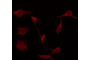 Image no. 2 for anti-Tachykinin Receptor 1 (TACR1) (Internal Region) antibody (ABIN6257514)