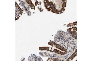 anti-Mitochondrial Calcium Uniporter (MCU) antibody