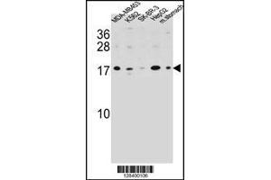 Image no. 2 for anti-S100 Calcium Binding Protein Z (S100Z) (AA 1-30), (N-Term) antibody (ABIN654583)