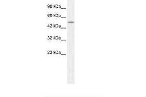 Image no. 1 for anti-CAMP Responsive Element Binding Protein 3-Like 2 (CREB3L2) (AA 34-72) antibody (ABIN202707)