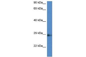 anti-N(alpha)-Acetyltransferase 11, NatA Catalytic Subunit (NAA11) (Middle Region) antibody