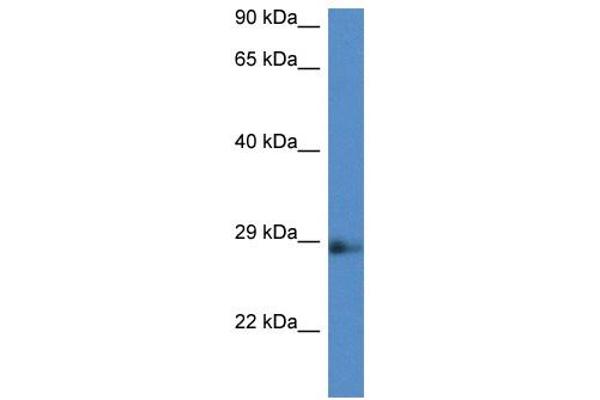 anti-N(alpha)-Acetyltransferase 11, NatA Catalytic Subunit (NAA11) (Middle Region) antibody