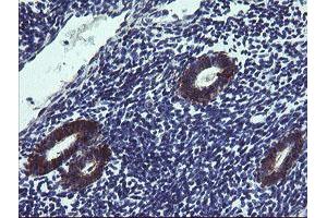 Image no. 3 for anti-Tumor Protein D52-Like 3 (TPD52L3) antibody (ABIN1501475)