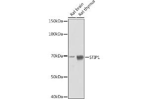 Western blot analysis of extracts of various cell lines, using STIP1 Rabbit mAb (ABIN1512566, ABIN3020619, ABIN3020620 and ABIN7101303) at 1:1000 dilution.