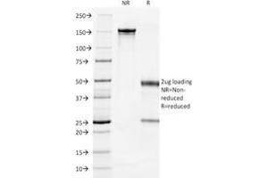 Image no. 6 for anti-Keratin 7 (KRT7) antibody (ABIN6939871)