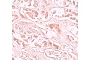 Image no. 3 for anti-Protein BANP (BANP) (Internal Region) antibody (ABIN6656119)
