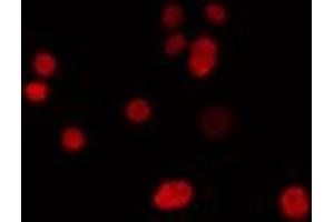 IRX1 antibody  (Internal Region)