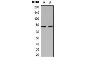 Image no. 2 for anti-Glyceronephosphate O-Acyltransferase (GNPAT) (Center) antibody (ABIN2706033)