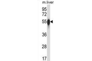 Image no. 2 for anti-Casein Kinase 1, gamma 3 (CSNK1G3) antibody (ABIN2997618)