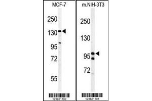 Image no. 1 for anti-TAF2 RNA Polymerase II, TATA Box Binding Protein (TBP)-Associated Factor, 150kDa (TAF2) (C-Term) antibody (ABIN2504244)