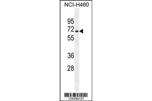 anti-Zinc Finger and SCAN Domain Containing 5B (ZSCAN5B) (AA 403-431), (C-Term) antibody