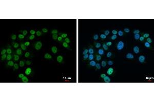 Image no. 2 for anti-ISL LIM Homeobox 1 (ISL1) (Center) antibody (ABIN2855485)