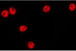 Image no. 1 for anti-Transcription Elongation Factor A (SII)-Like 1 (TCEAL1) (Internal Region) antibody (ABIN6258892)
