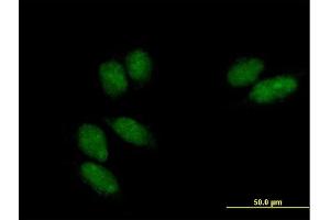 Image no. 2 for anti-SSU72 RNA Polymerase II CTD Phosphatase Homolog (SSU72) (AA 1-194) antibody (ABIN526076)