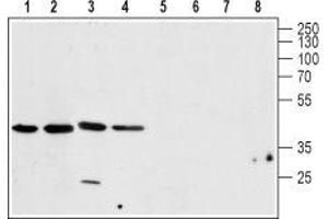 Western blot analysis of rat brain (lanes 1 and 5), mouse brain (lanes 2 and 6), human U-87 MG brain glioblastoma cell line (lanes 3 and 7) and rat C6  brain glioma cell line (lanes 4 and 8) lysates: - 1-4.