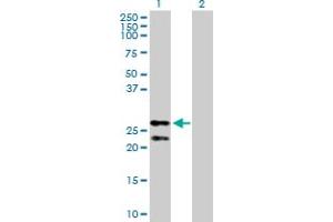 Image no. 1 for anti-Peroxiredoxin 3 (PRDX3) (AA 1-256) antibody (ABIN524344)