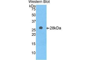 Image no. 1 for anti-alpha-1-B Glycoprotein (A1BG) (AA 22-219) antibody (ABIN1176303)