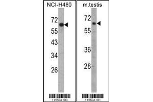 Image no. 1 for anti-Fascin 3 (FSCN3) (AA 1-30), (N-Term) antibody (ABIN390722)