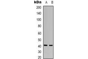 Image no. 2 for anti-RRS1 Ribosome Biogenesis Regulator (RRS1) antibody (ABIN2801326)