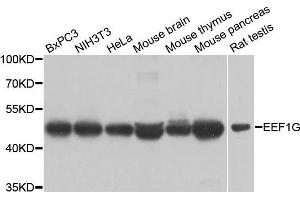 Image no. 1 for anti-Eukaryotic Translation Elongation Factor 1 gamma (EEF1G) antibody (ABIN3016525)