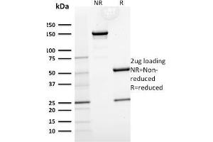 Image no. 1 for anti-Keratin 15 (KRT15) antibody (ABIN6939912)