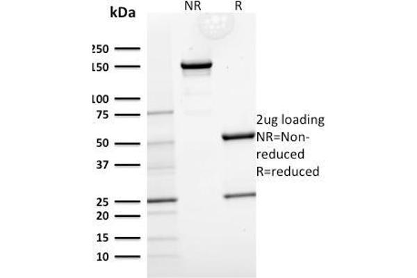 anti-Keratin 15 (KRT15) antibody