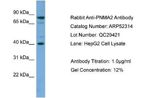 Image no. 2 for anti-Paraneoplastic Antigen MA2 (PNMA2) (Middle Region) antibody (ABIN2784877)
