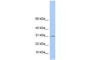 Image no. 1 for anti-Enoyl CoA Hydratase Domain Containing 1 (ECHDC1) (Middle Region) antibody (ABIN630734)
