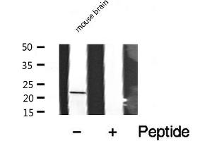 Image no. 1 for anti-Cysteine and Glycine-Rich Protein 1 (CSRP1) (Internal Region) antibody (ABIN6258036)