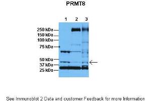 Image no. 2 for anti-Protein Arginine Methyltransferase 8 (PRMT8) (C-Term) antibody (ABIN2778661)