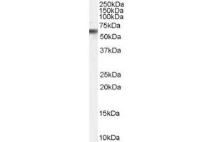 Image no. 2 for anti-Vacuolar Protein Sorting 45 (VPS45) (C-Term) antibody (ABIN185111)